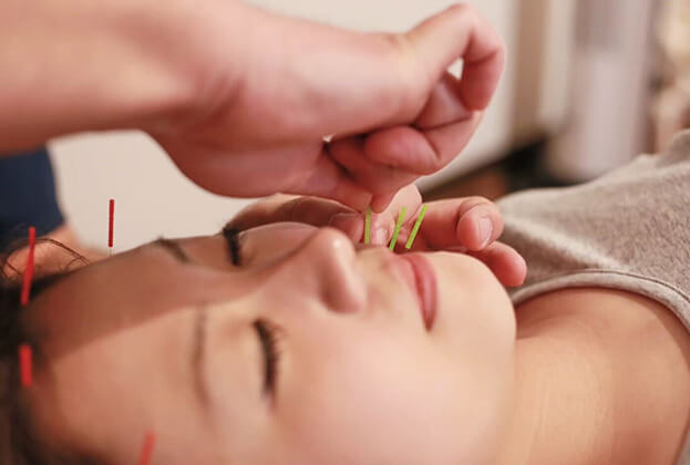 心地の良い美容鍼